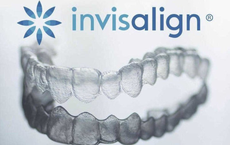 Mách bạn địa chỉ niềng răng invisalign uy tín tại Hà Nội