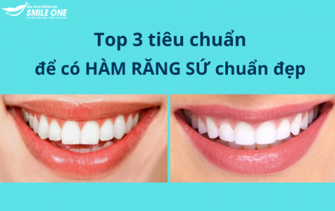Top 3 tiêu chuẩn để có hàm răng sứ chuẩn đẹp