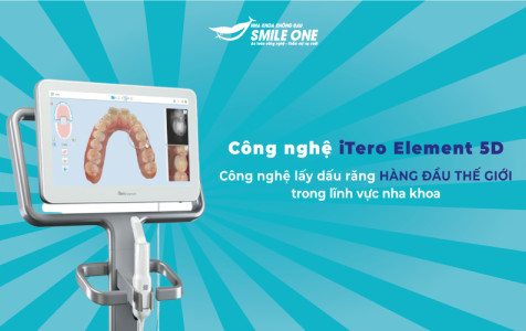 Công nghệ iTero Element 5D - Công nghệ lấy dấu răng hàng đầu thế giới trong lĩnh vực nha khoa
