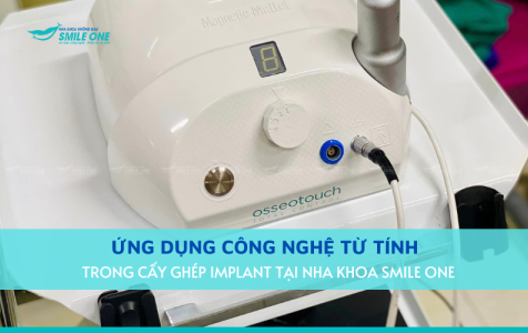 Nha khoa Smile One tiên phong ứng dụng công nghệ từ tính trong điều trị
