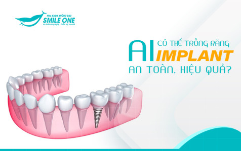 Ai có thể trồng răng implant an toàn, hiệu quả