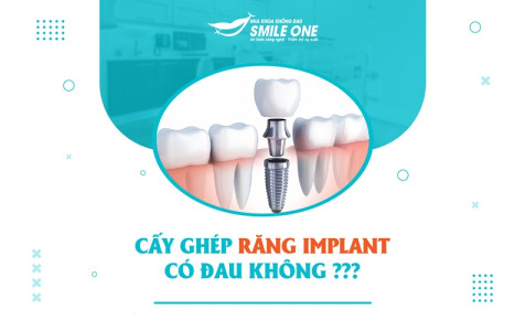 [GIẢI ĐÁP] Cấy ghép Implant có đau không?