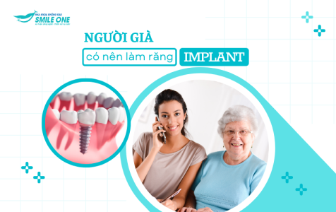 Người già có nên làm răng implant không