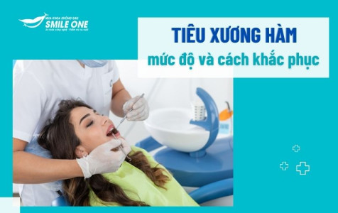 Các dạng tiêu xương hàm sau khi mất răng và cách khắc phục