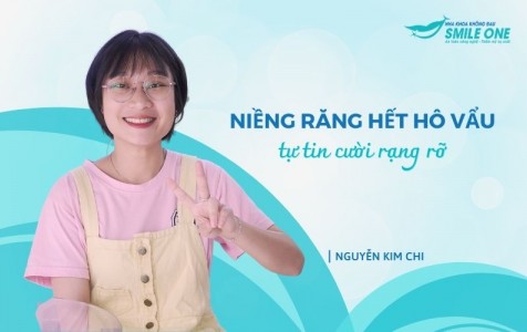 Nguyễn Kim Chi - Niềng răng hết hô vẩu, tự tin cười rạng rỡ
