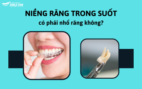 Niềng răng trong suốt có phải nhổ răng không? 