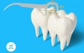 Kẽ răng có mùi hôi: Nguyên nhân và Bí kíp xử lý tại nhà