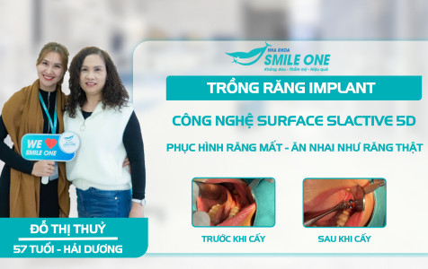 Trẻ ra chục tuổi sau 33 năm nhờ trồng răng Implant Của Bác Gái Hải Dương