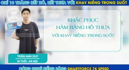 Chỉ 18 tháng Anh Duy đã khắc phục thành công răng hô với khay niềng trong suốt