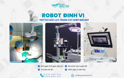 Rô bốt định vị – Trợ thủ đắc lực giúp cấy ghép Implant an toàn, nhanh chóng tại nha khoa Smile One