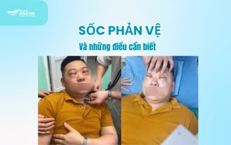 Nguy cơ sốc phản vệ và những điều cần biết khi xử trí