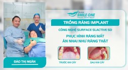 Đỉnh cao công nghệ cấy implant không rạch vạt lợi an toàn cho người cao huyết áp