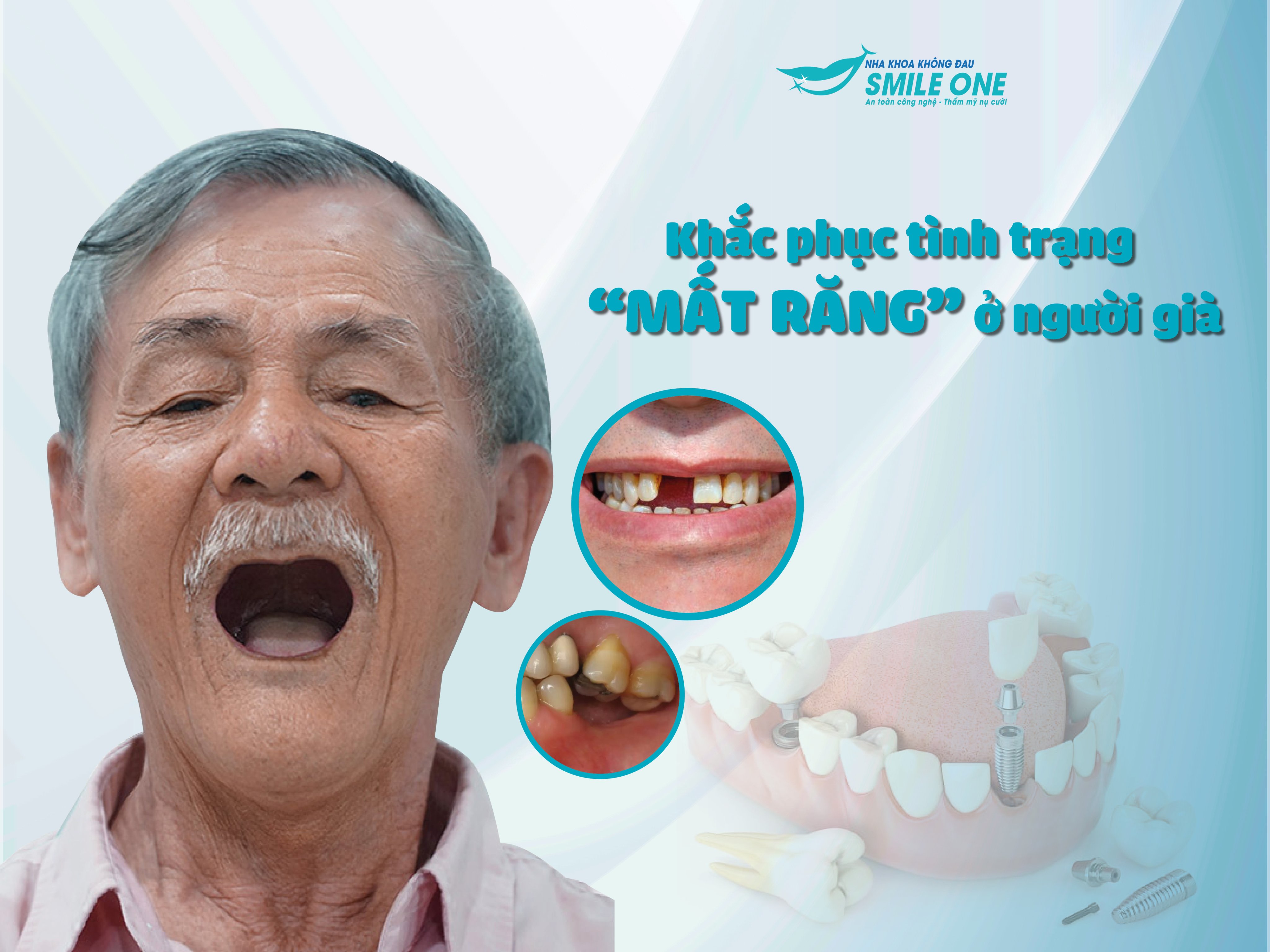 Khắc phục tình trạng mất răng ở người già