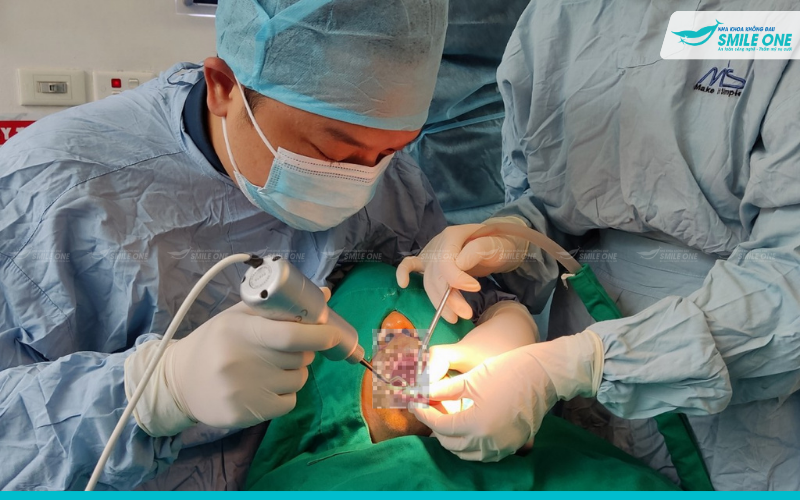 Nha khoa Smile One ứng dụng công nghệ từ tính trong cấy ghép implant 5