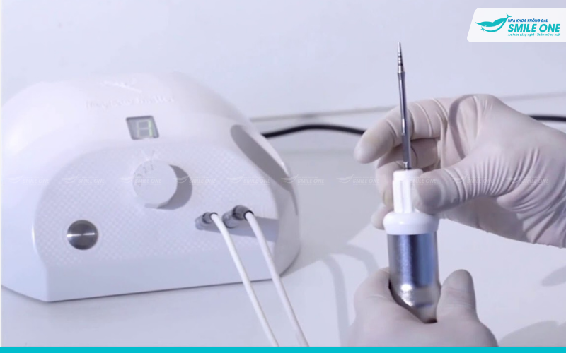 Nha khoa Smile One ứng dụng công nghệ từ tính trong cấy ghép implant 3