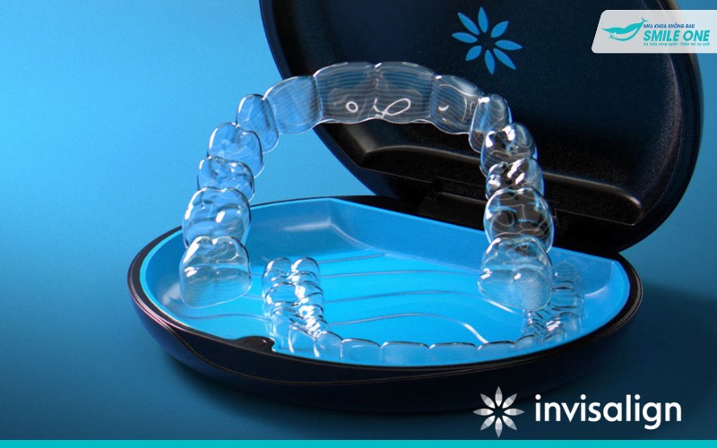 Các loại niềng răng trong suốt giúp chỉnh răng hiệu quả 2