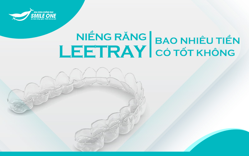 Giá thành điều trị khay niềng răng trong suốt Leetray như thế nào?