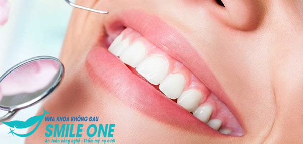 Hàm răng trắng đẹp là ntn 5 cách có hàm răng trắng KHỎESÁNGBÓNG
