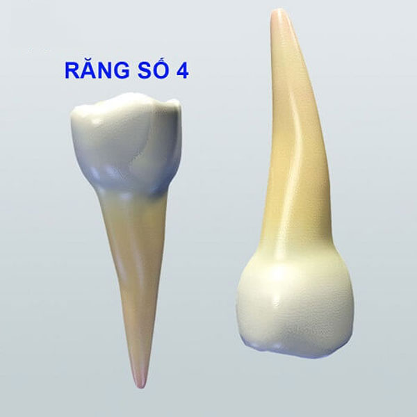 Răng Số 4 Có Mấy Chân? Những Thông Tin Về Niềng Răng Nhổ Răng Số 4 Bạn Cần  Biết