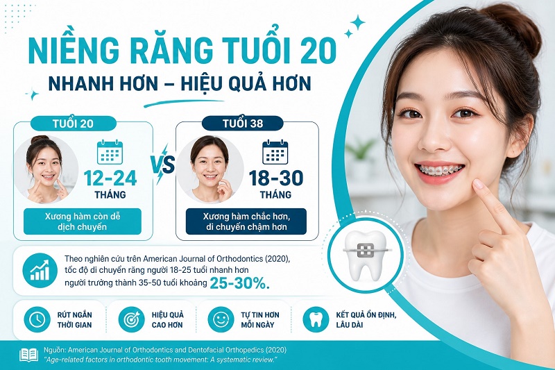 Niềng răng tuổi 20 thường mất 12-24 tháng - ngắn hơn người 38 tuổi 6-12 tháng
