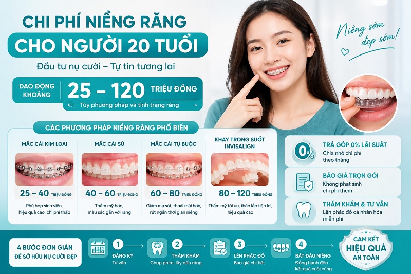 20 tuổi niềng răng bao nhiêu tiền? Chi phí thường dao động từ 25–120 triệu đồng