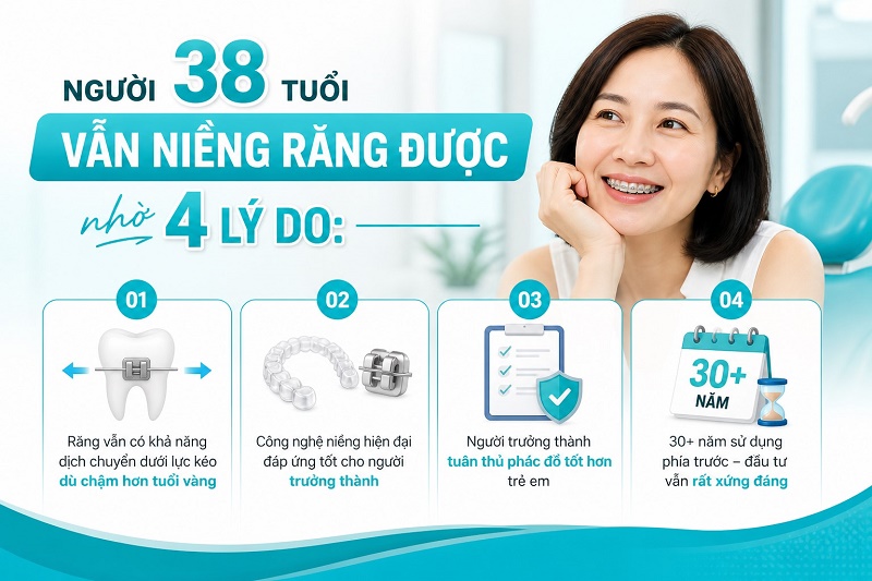 Người 38 tuổi vẫn niềng răng được nhờ 3 lý do: răng vẫn dịch chuyển dưới lực kéo,