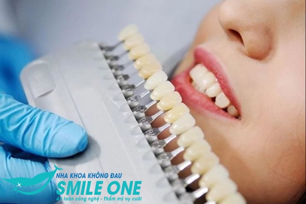 cách chọn màu răng sứ thẩm mỹ