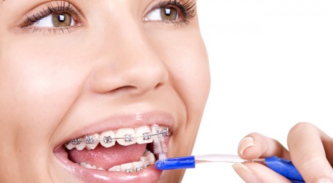 nieng-rang-20-trieu-1