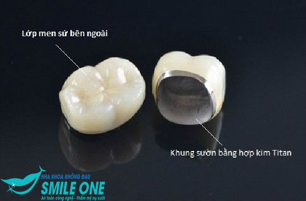 răng sứ thẩm mỹ ở hà nội