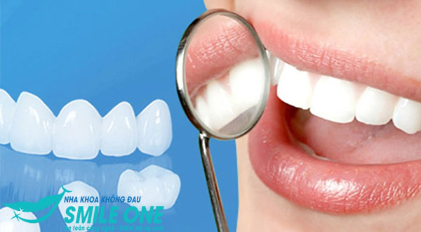 bọc răng sứ thẩm mỹ hết bao nhiêu