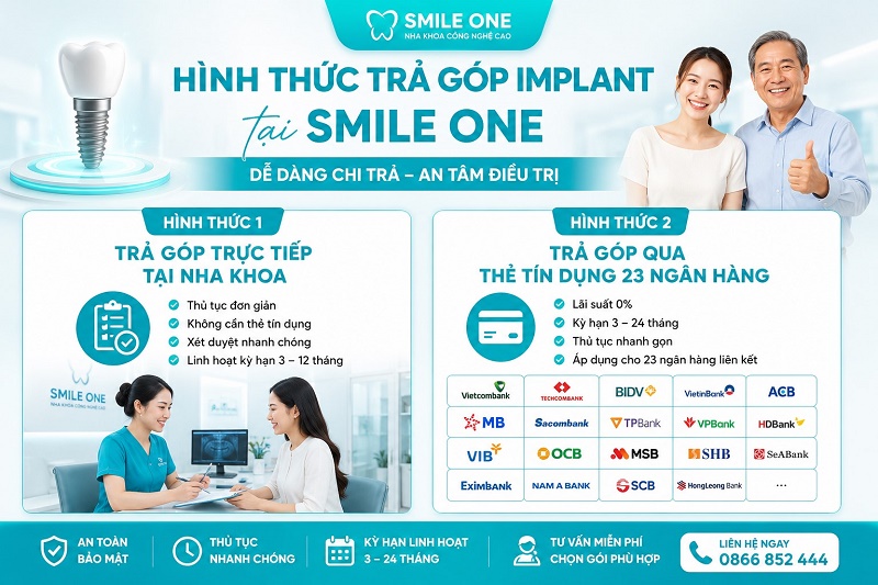 Các hình thức trả góp Implant