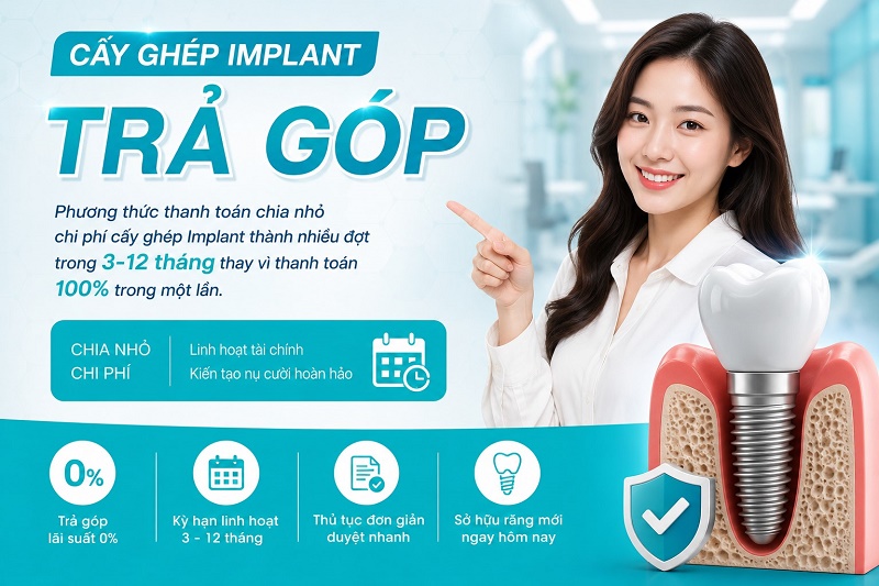 Vì sao nên trồng răng Implant trả góp