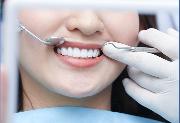 Chữa cười hở lợi để thay đổi tướng số