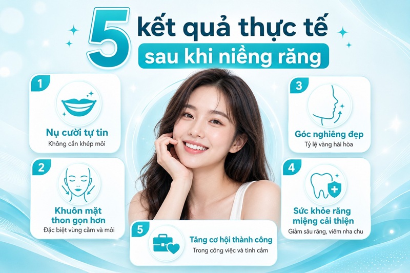 nụ cười tự tin không cần khép môi, khuôn mặt thon gọn hơn (đặc biệt vùng cằm và môi)