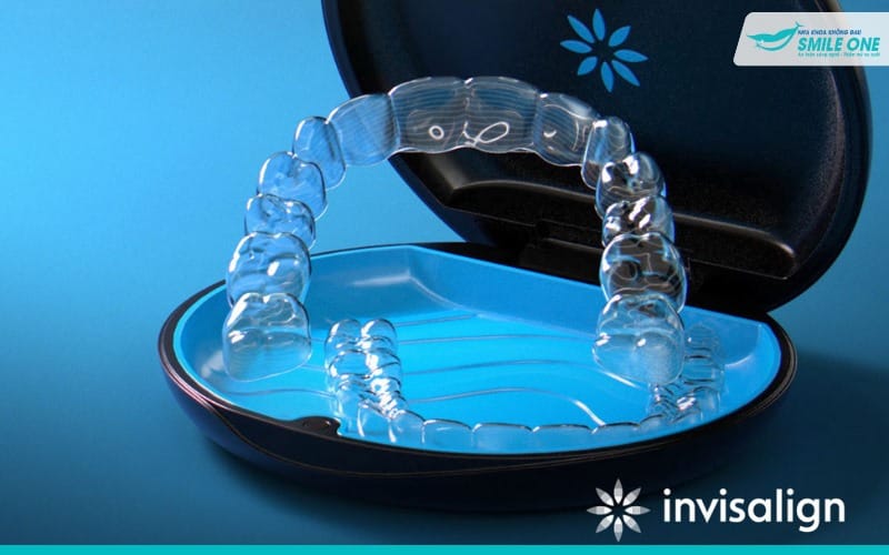 Niềng răng trong suốt Invisalign được sản xuất tại công ty Align Mỹ