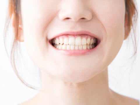 bảng giá điều trị cười hở lợi