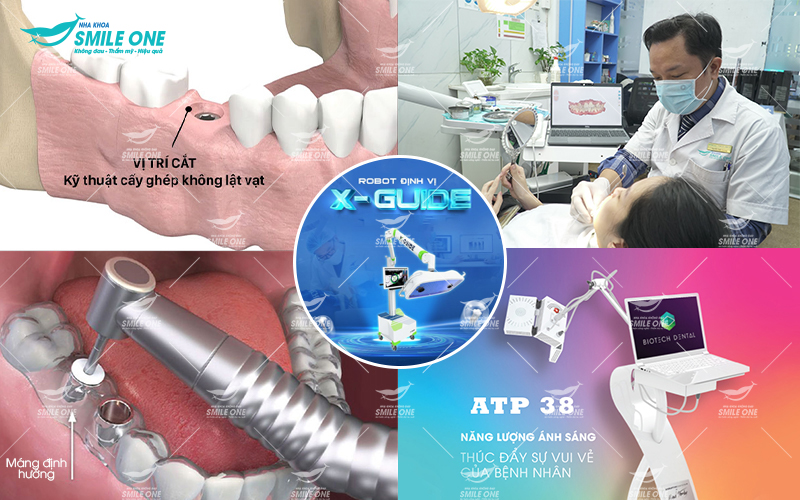 Trang thiết bị nha khoa hiện đại đạt chuẩn quốc tế tại Smile One