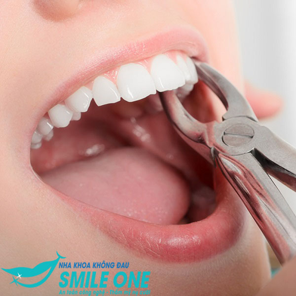 so-sanh-nho-rang-thong-thuong-va-nho-rang-bang-may-piezotome