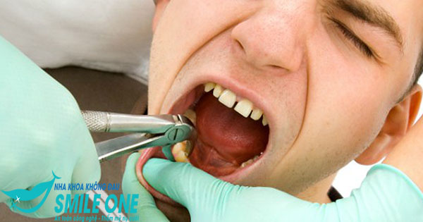 nho-rang-khon-bi-u-tai