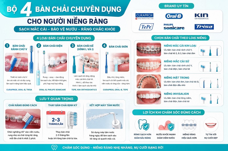 Người niềng răng nên kết hợp bàn chải lông mềm/siêu mềm (đầu nhỏ, rãnh chữ V),