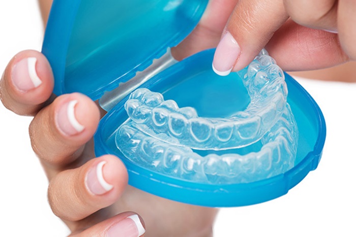 nieng-rang-thua-khong-mac-cai-1