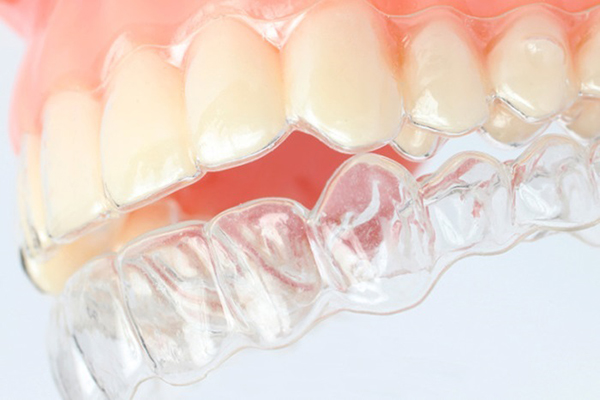 nieng-rang-thua-khong-mac-cai-333