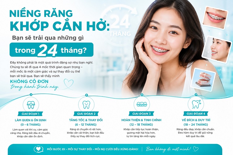 Ưu điểm khi niềng khắc phục khớp cắn hở