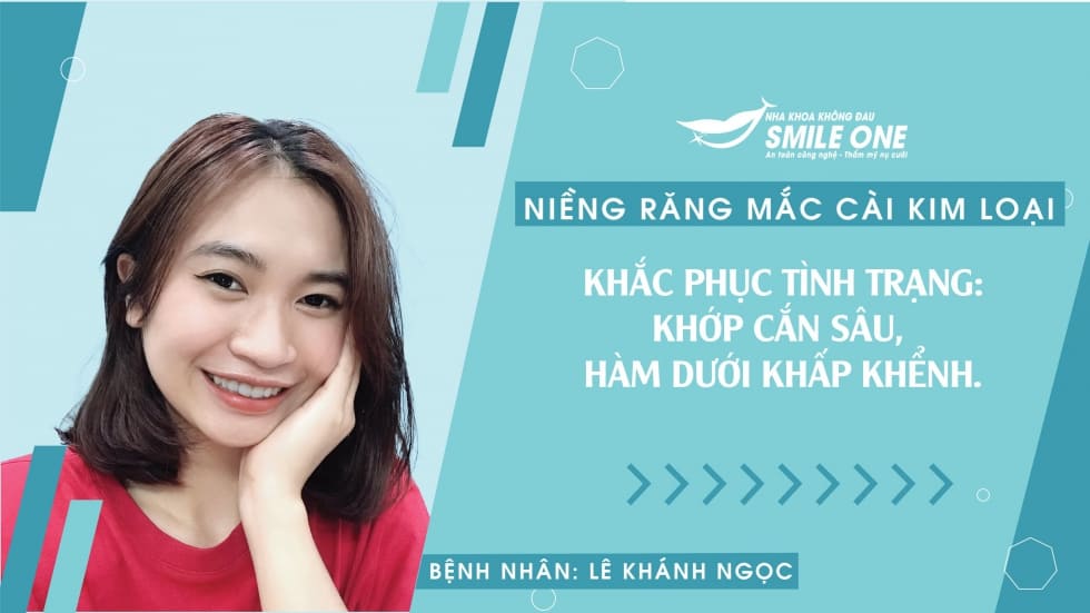 Quy trình niềng răng mắc cài 8 bước tại Smile One