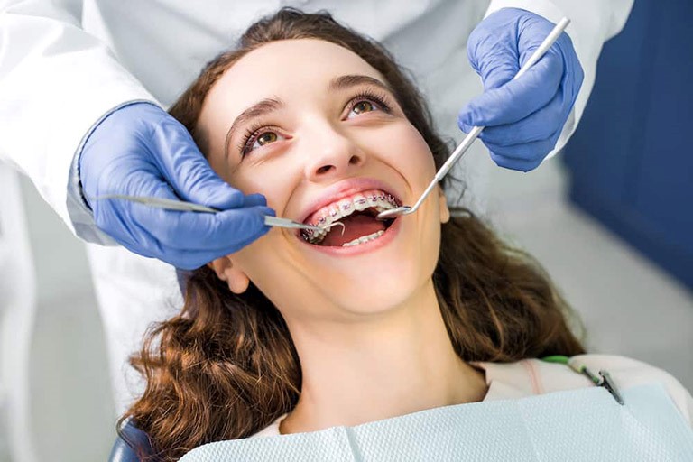Cơ chế tự khóa của mắc cài cánh cam
