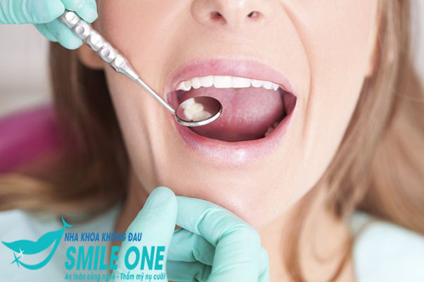 Trước khi niềng răng bạn cần đến nha khoa để các bác sĩ nha khoa trực tiếp thăm khám, xác định tình trạng răng miệng cũng như mức độ sai lệch của răng để đưa ra phương án điều trị hợp lý.