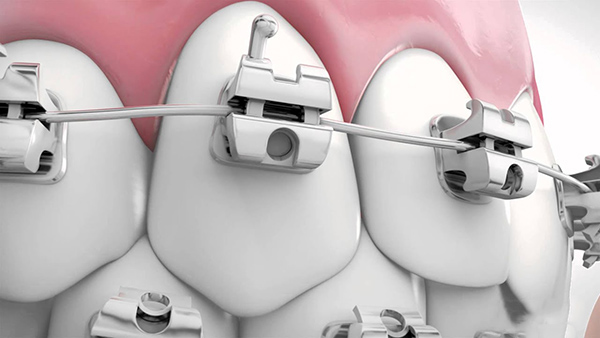 nieng-rang-sau-9-thang