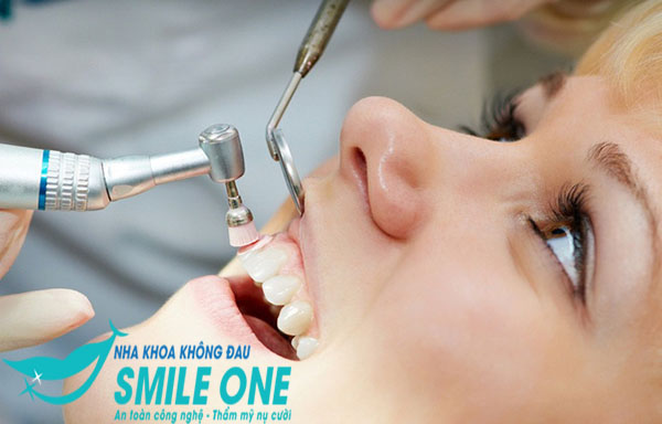 niềng răng dùng bàn chải gì