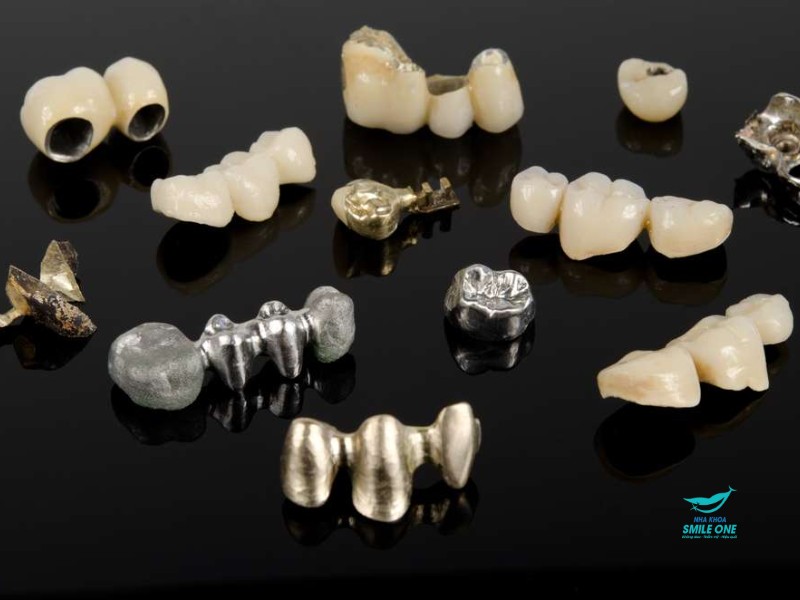 răng sứ kim loại