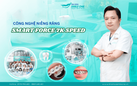 Công nghệ Smart Force 7k Speed rút ngắn thời gian niềng răng, tiết kiệm ...